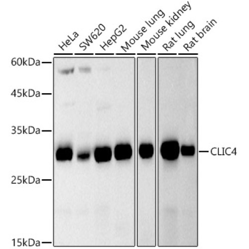 CLIC4 Rabbit mAb