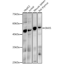 SNX5 Rabbit mAb