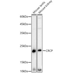 CRCP Rabbit mAb