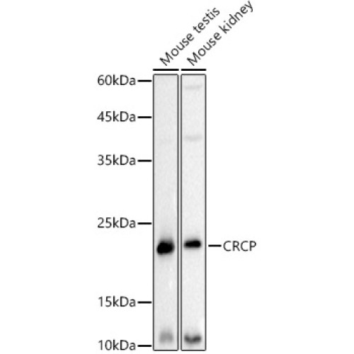 CRCP Rabbit mAb