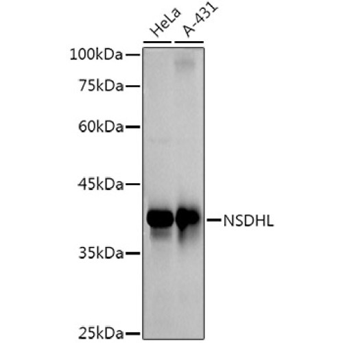 NSDHL Rabbit mAb