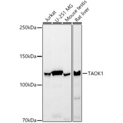 TAOK1 Rabbit mAb