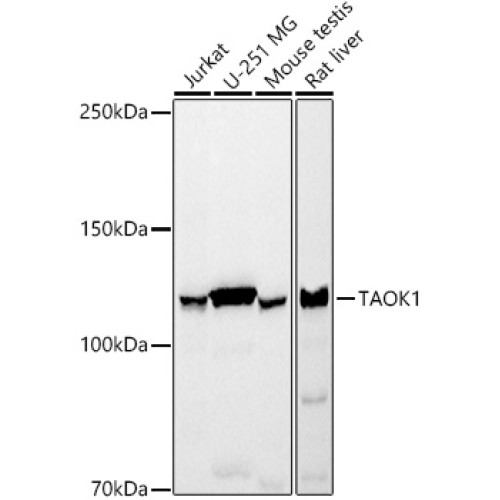 TAOK1 Rabbit mAb