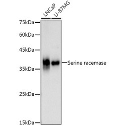 Serine racemase Rabbit mAb