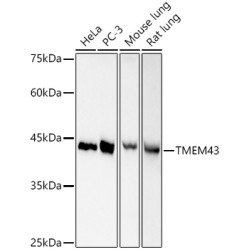 TMEM43 Rabbit mAb