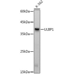 ULBP1 Rabbit mAb