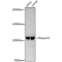 Nesprin3 Rabbit mAb