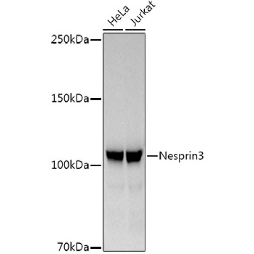 Nesprin3 Rabbit mAb