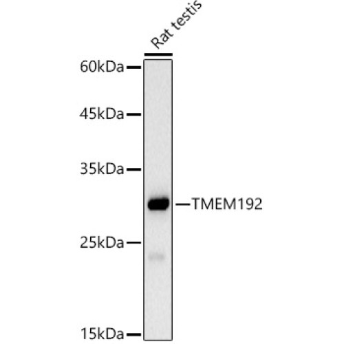 TMEM192 Rabbit mAb