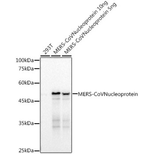 MERS-CoV Nucleoprotein Rabbit mAb