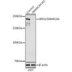 [KO Validated] BRG1/SMARCA4 Rabbit pAb