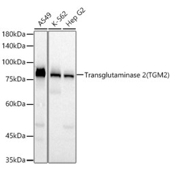 Transglutaminase 2 (TGM2)  Rabbit mAb