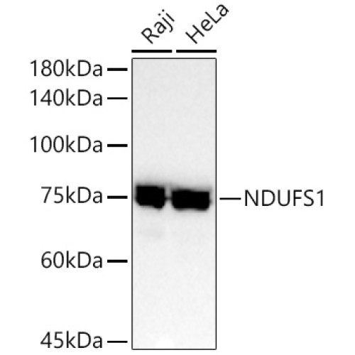 NDUFS1 Rabbit mAb