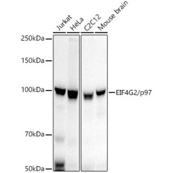 EIF4G2/p97 Rabbit mAb