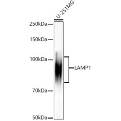 [KD Validated] LAMP1/CD107a Rabbit mAb