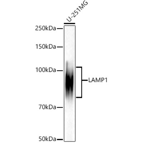 [KD Validated] LAMP1/CD107a Rabbit mAb