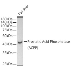 Prostatic Acid Phosphatase (PSAP)  Rabbit mAb