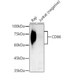 CD86 Rabbit mAb
