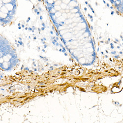 Transgelin (TAGLN) Rabbit mAb