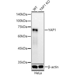 [KO Validated] YAP1 Rabbit mAb
