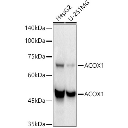 ACOX1 Rabbit mAb
