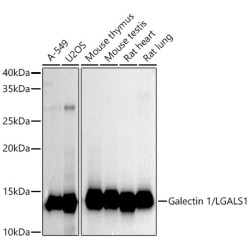 Galectin 1/LGALS1 Rabbit mAb