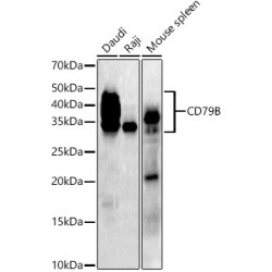 CD79B Rabbit mAb