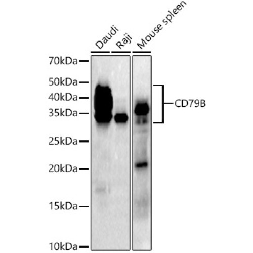 CD79B Rabbit mAb