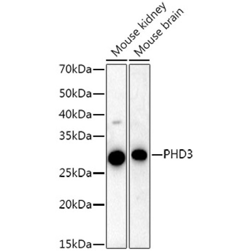PHD3 Rabbit mAb