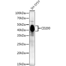 CD200 Rabbit mAb