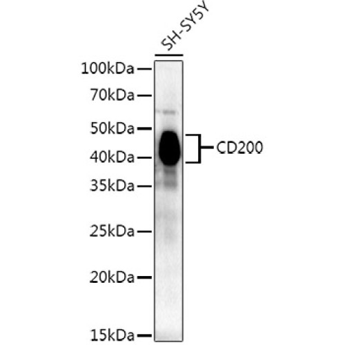 CD200 Rabbit mAb