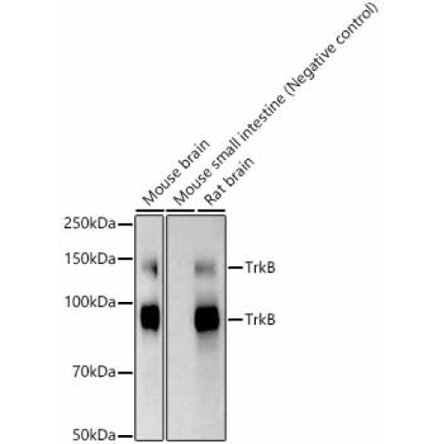 TrkB Rabbit mAb