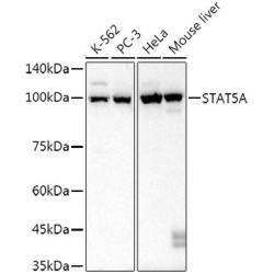 STAT5A Rabbit mAb