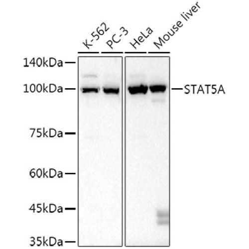 STAT5A Rabbit mAb