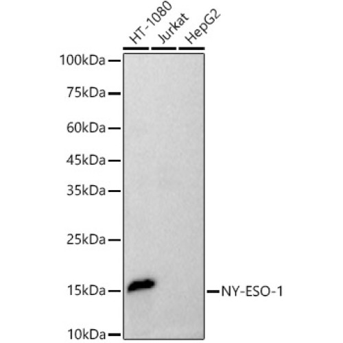 NY-ESO-1 Rabbit mAb
