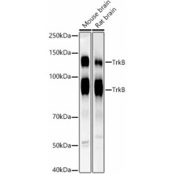TrkB Rabbit mAb