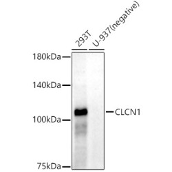 CLCN1 Rabbit mAb