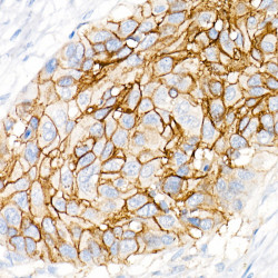 CD141/Thrombomodulin Rabbit mAb