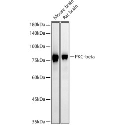 PKC-beta Rabbit mAb