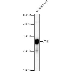 Cardiac Troponin I (TNNI3) Rabbit mAb