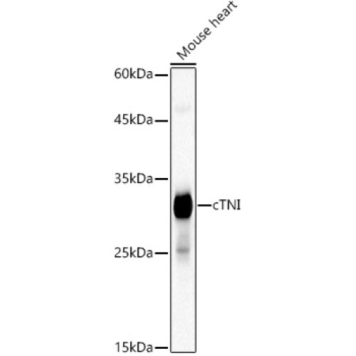Cardiac Troponin I (TNNI3) Rabbit mAb