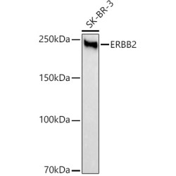 HER2/ErbB2 Rabbit mAb