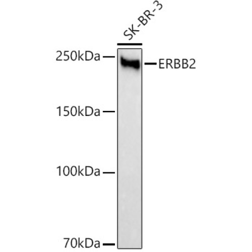 HER2/ErbB2 Rabbit mAb