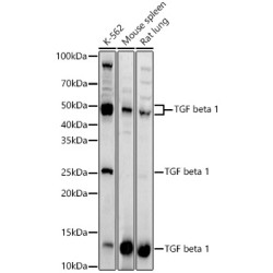 TGF beta 1 Rabbit pAb