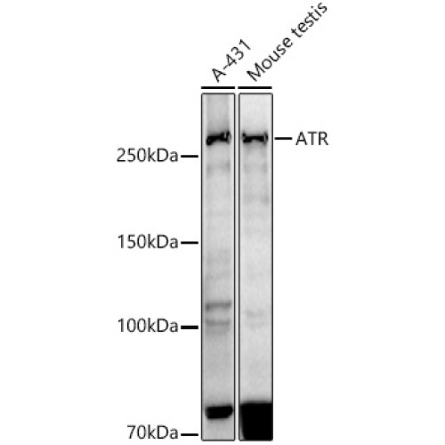 ATR Rabbit mAb