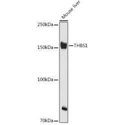 THBS1 Rabbit pAb