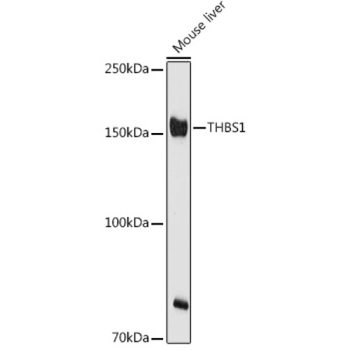 THBS1 Rabbit pAb