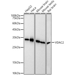VDAC2 Rabbit mAb