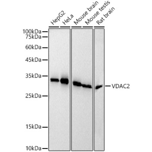 VDAC2 Rabbit mAb