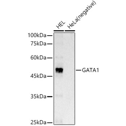 GATA1 Rabbit mAb